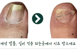 문제성 발톱 관리는 어디서 ?